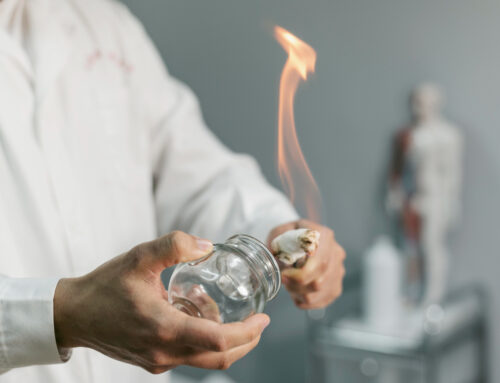 ¿Qué es el cupping?